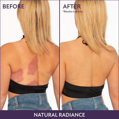 💫Last Day Promotion✨Westmore Body Coverage Perfector – Waterproof, lightweight & flawless body makeup